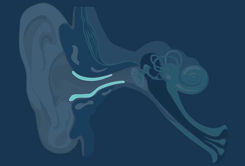 ear wax removal diagram