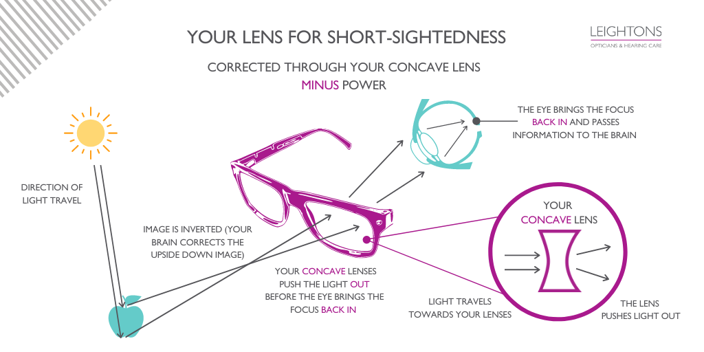 Your Lens Prescription  for Short Sightedness: A diagram