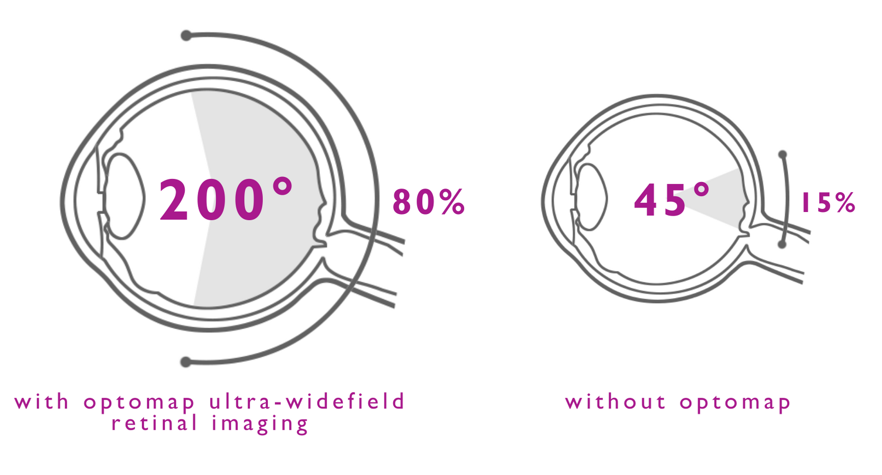 optomap with ulta-wide retinal imaging diagram