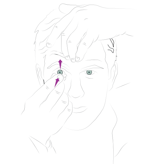 A diagram demonstrating how to gently pull apart eyelids.