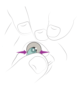 A diagram demonstrating how to pinch a contact lens for removal.