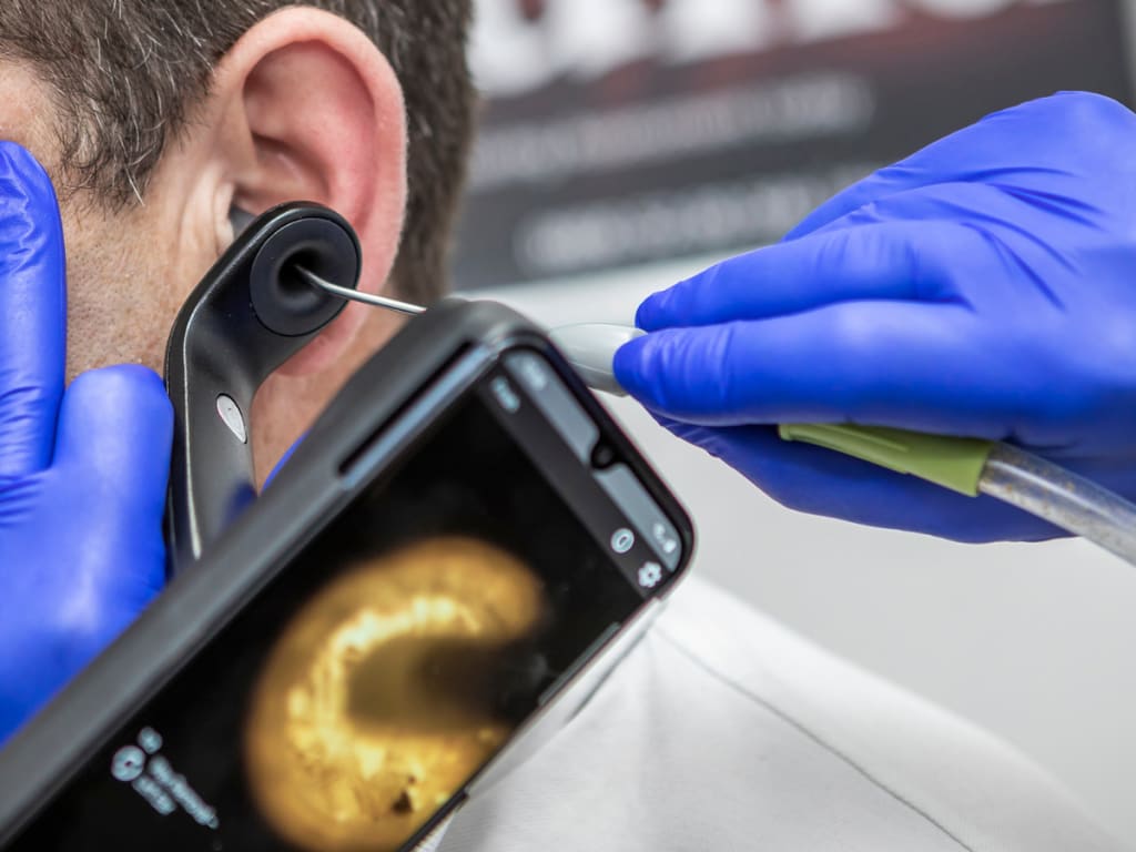 What is ear wax and how can you manage it? The Hearing Care Partnership