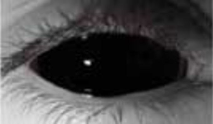 Black Sclera