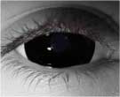 Mini Sclera