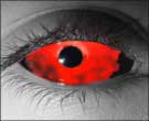 Bloodlust