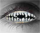 Skeletal Teeth