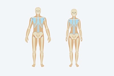 Photo d'illustation pour Oligospondylites rhumatismales