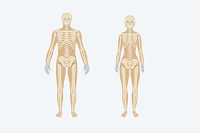 Photo d'illustation pour Polyarthrite Rhumatoide