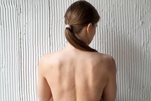 Cure thermale en dermatologie : eczéma, psoriasis, acné… quelles stations choisir ?