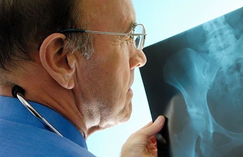 Ostéoporose et cure thermale, une aide pour atténuer les douleurs