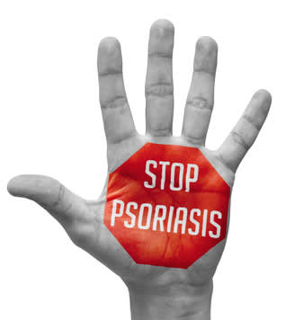 Stop Psoriasis Concept on Open Hand.