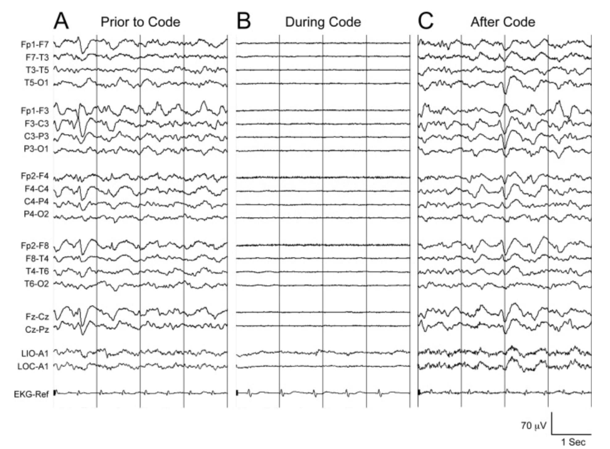 Why do I believe preserving structure is enough?