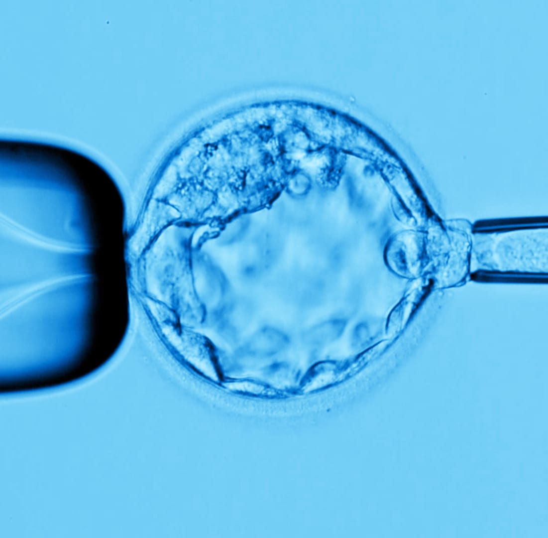 The Blastocyst Biopsy - RGI