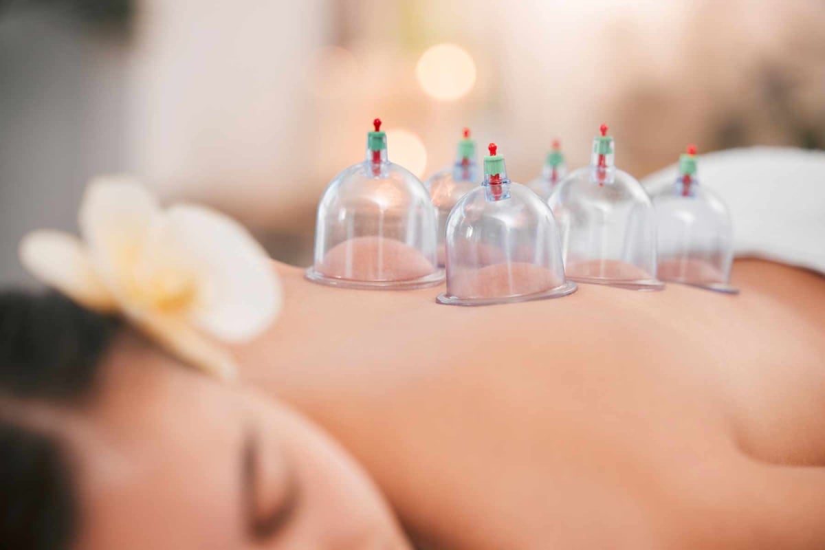 Find a cupping therapy provider near you