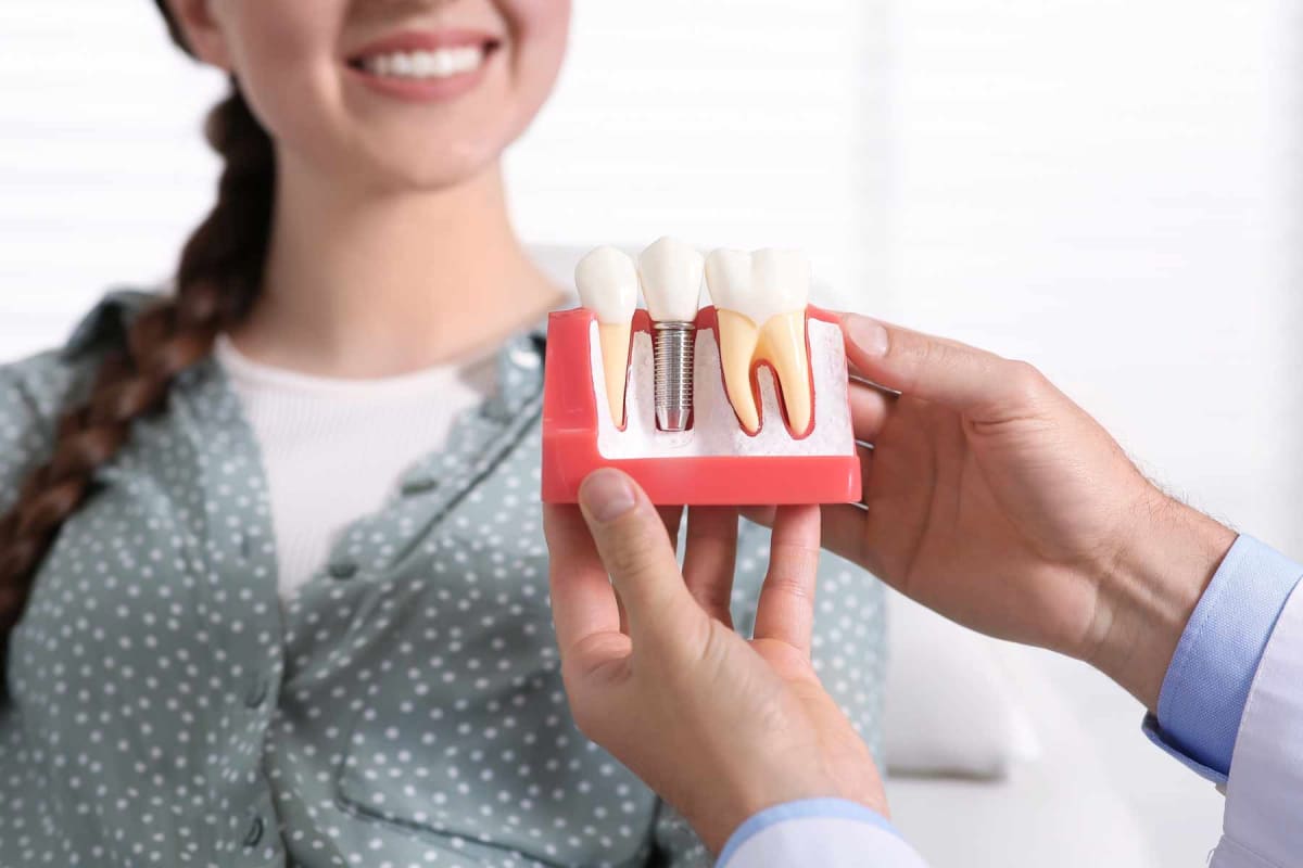 How much do dental implants cost?