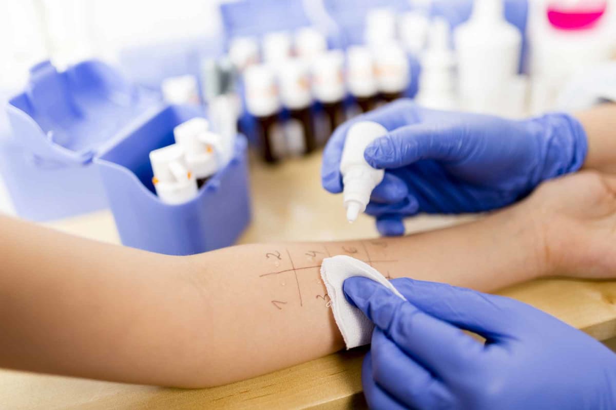 How much does an allergy test cost?