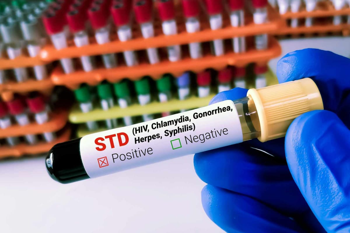 How much does STD testing cost?