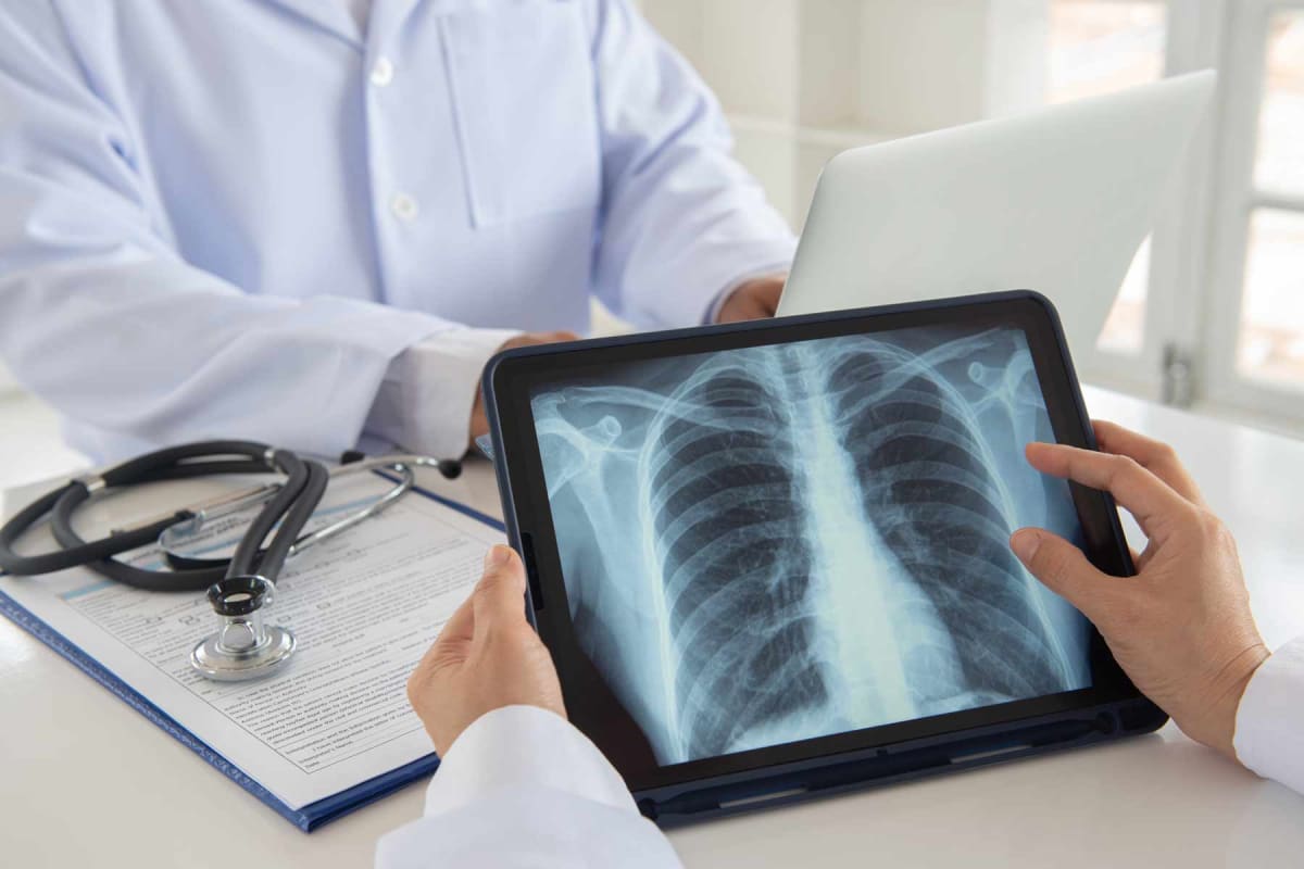 How much does an X-ray cost?