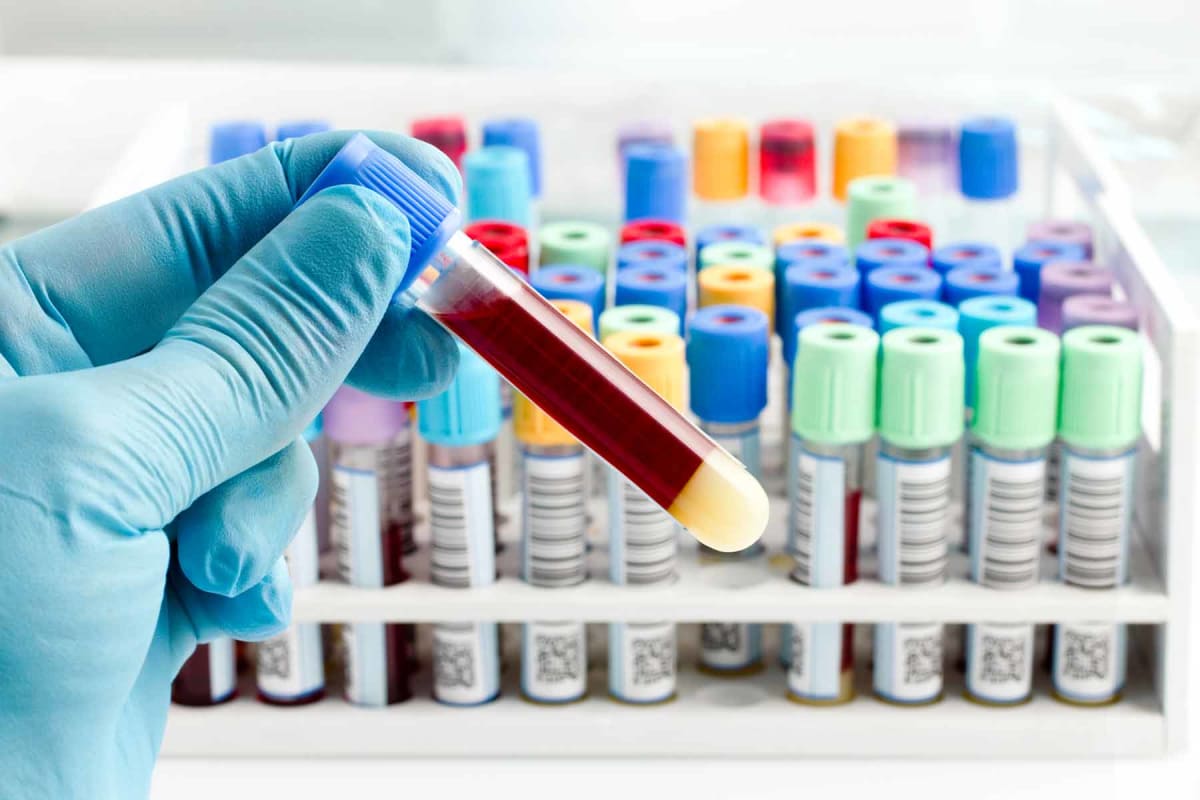 How much does blood work cost?