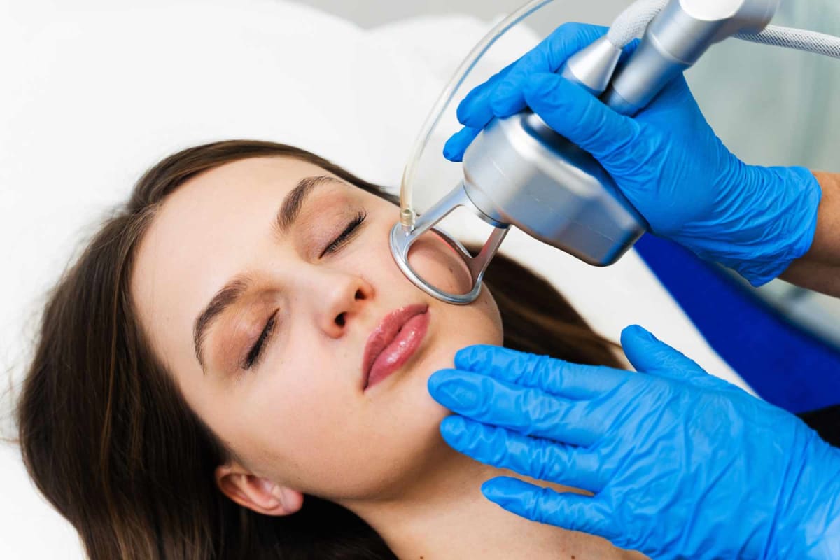 How much does laser resurfacing cost?