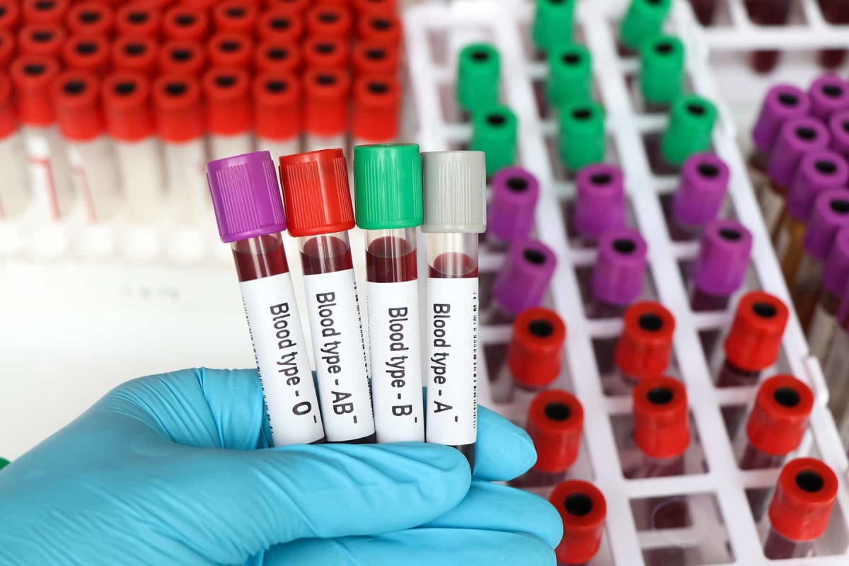 How much does a blood type test cost?