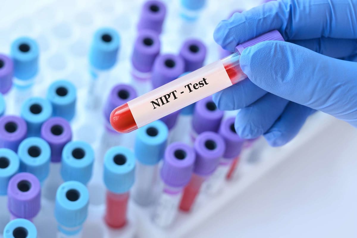 How much does a NIPT test cost?