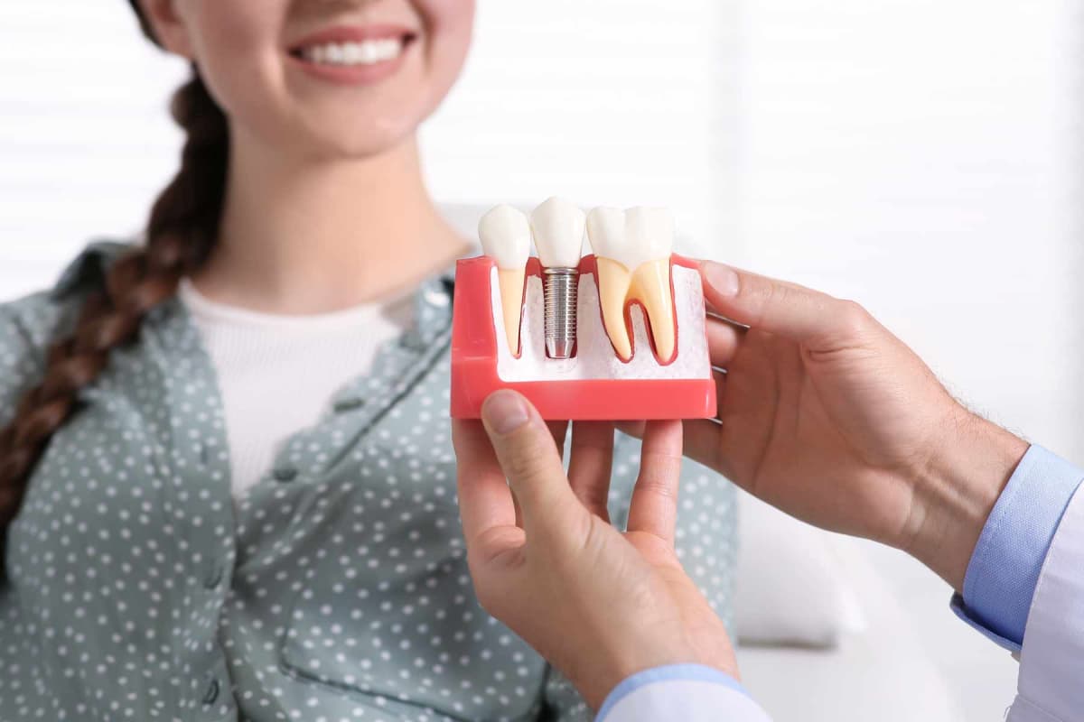 How much do dental implants cost?