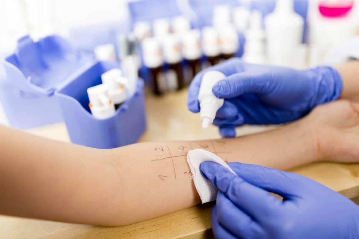How much does an allergy test cost?