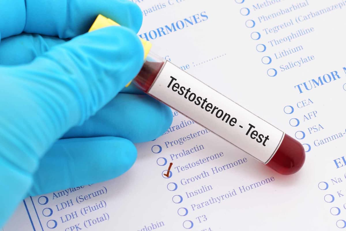 How much does a testosterone test cost?