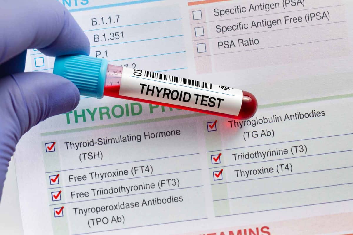 How much does a thyroid hormone test cost?