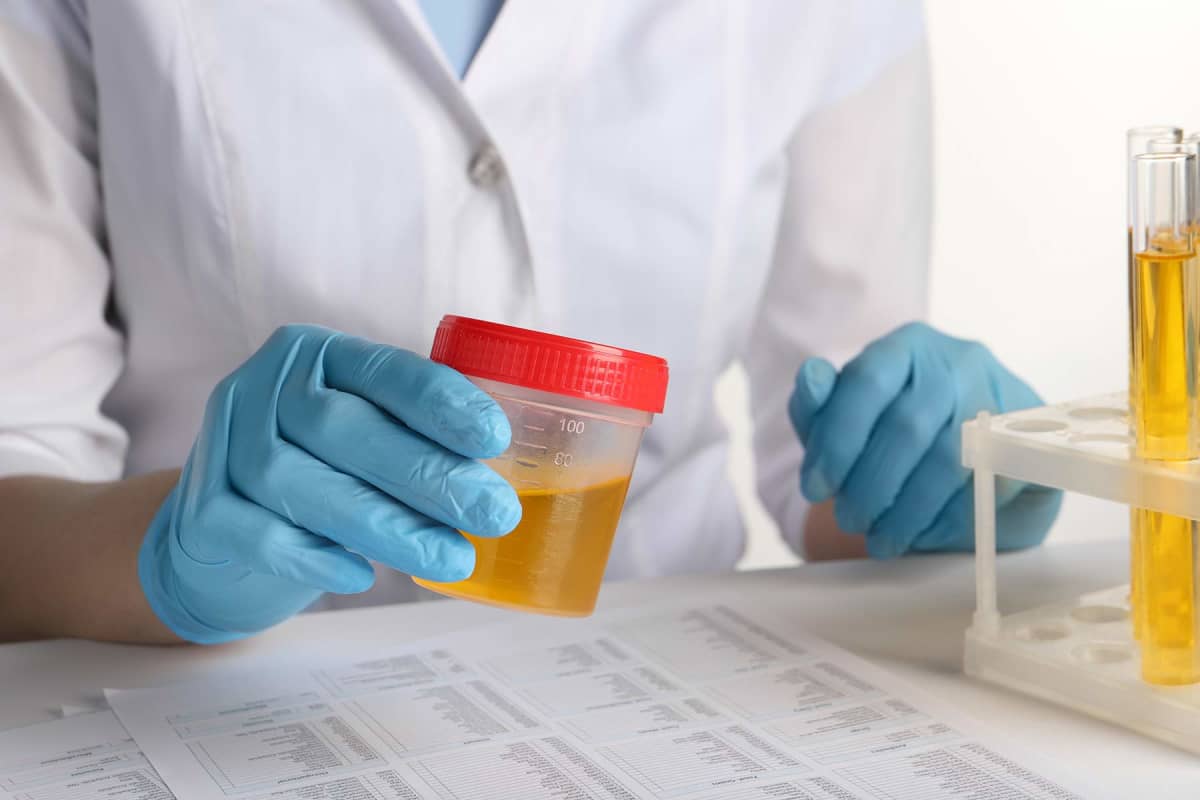 How much does a urinalysis cost?