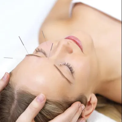 Houston Medical Acupuncture