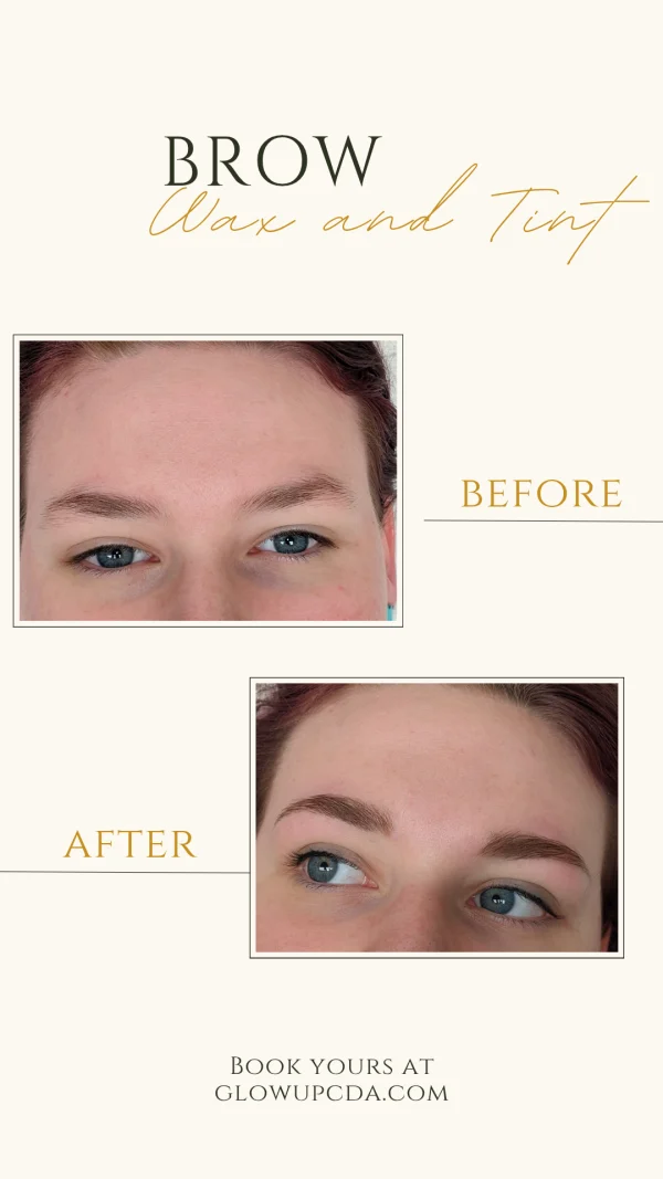 Brow transformation 