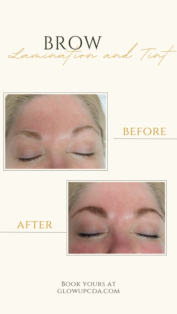 Brow transformation 
