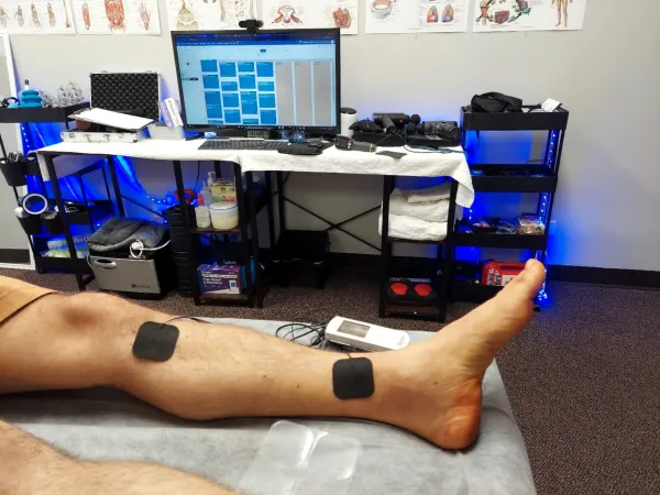 Nerve Stimulation for Rest Leg Syndrome.