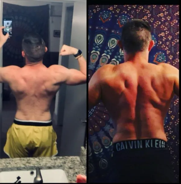 My before and after back picture