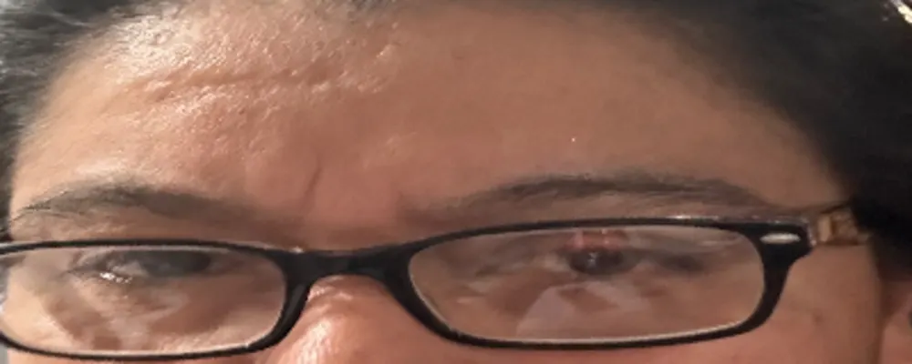 Limpieza De Paíz
