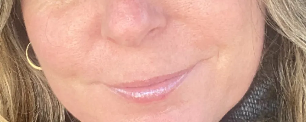 Beth Lloyd, LLC