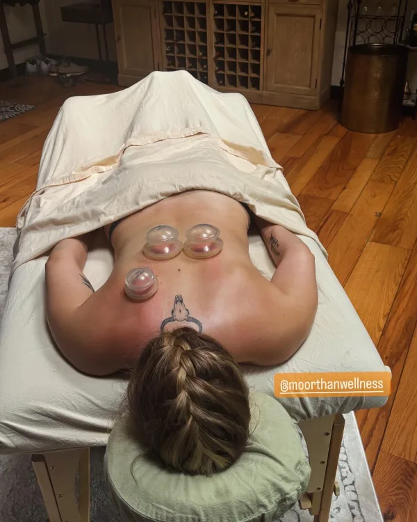 Cupping add on