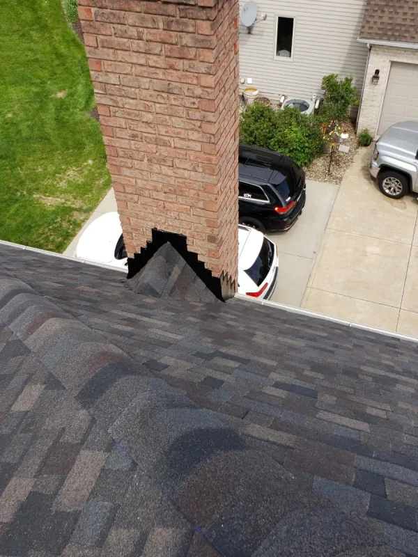 Shingles