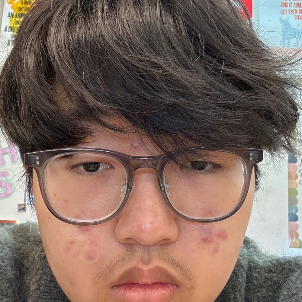 Aaron Kim