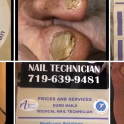 Euro Nails Medical Advance Pedicure