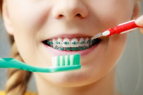 Traditional Braces - young girl with toothbrush showing braces