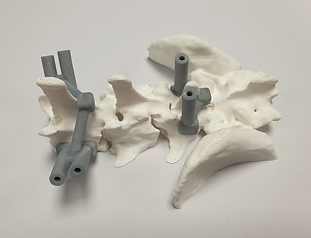 Patient-specific surgical equipment