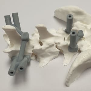 Drilling guide (DLP)