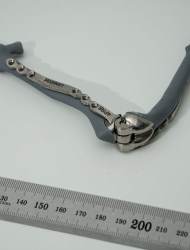 Internal stabilization