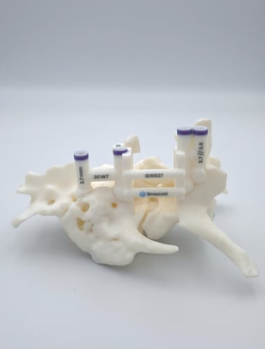 PERSIC - Custom 3D-Printed Spinal Surgical Guide System for Dogs & Cats