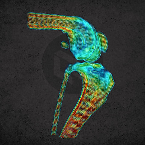 Denzitás alapú csontelemzés