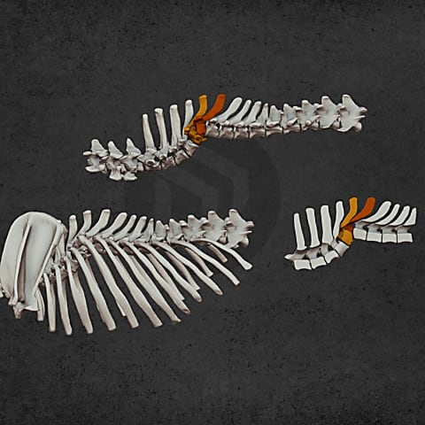 Vertebral deformation