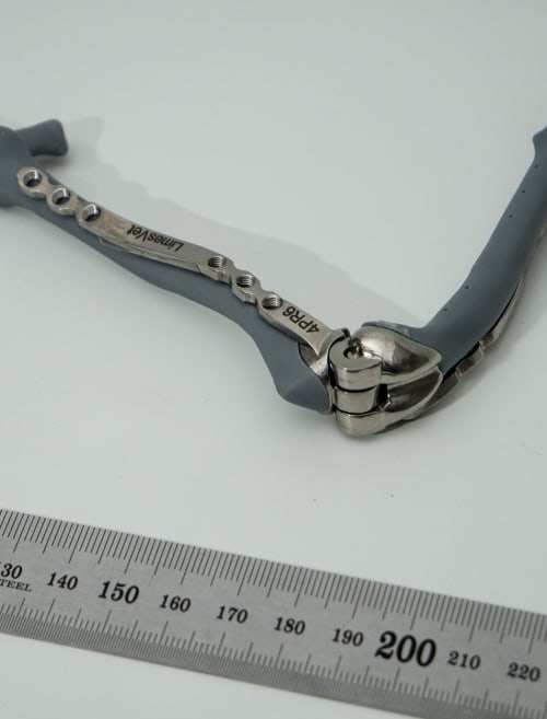 Belső stabilizálás